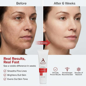 Alpha cream texture close-up showing smooth consistency for easy absorption