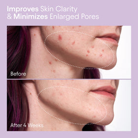 Alpyn liquid toner texture close-up illustrating lightweight absorbent formula