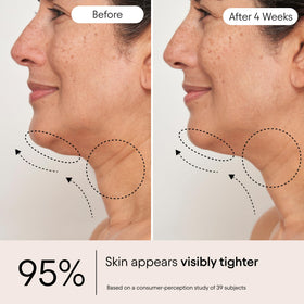 Model applying serum to jawline and décolleté illustrating refined contour benefits