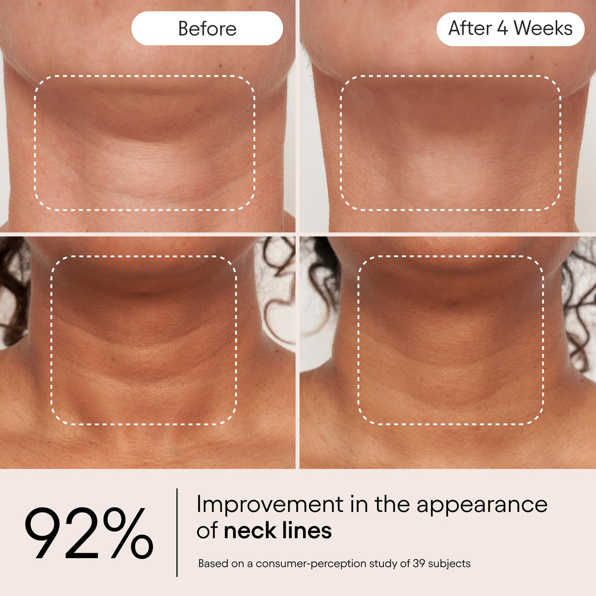 Alpyn serum being applied to neck demonstrating lifting technique and better absorption