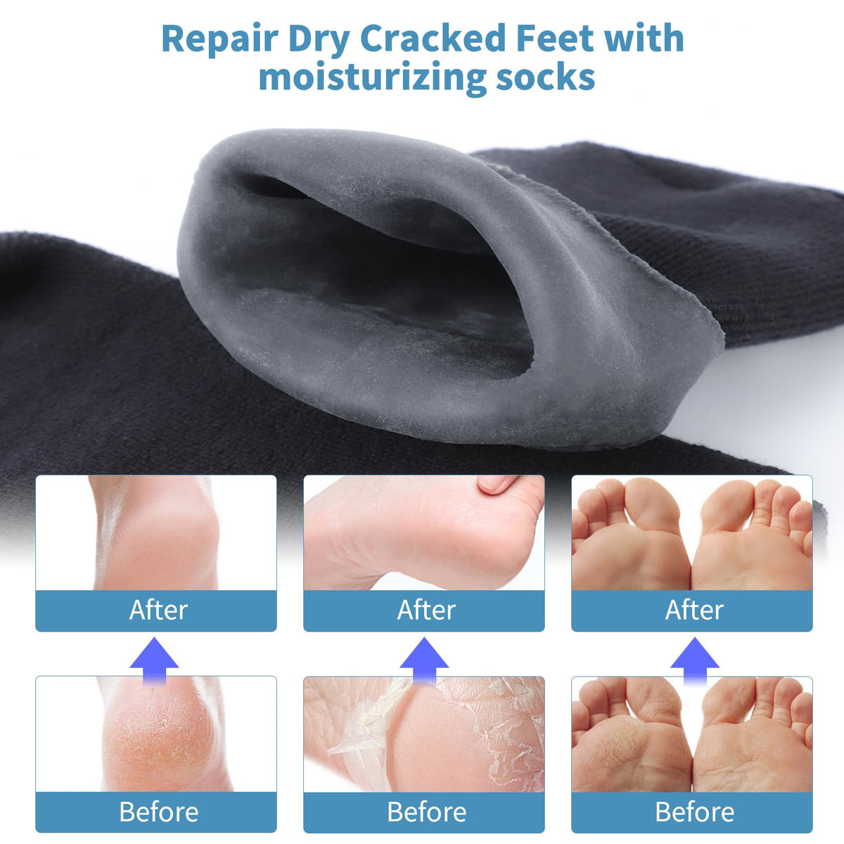 ALUROICE socks worn with cream applied showing enhanced moisture retention