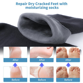 ALUROICE socks worn during treatment showing secure fit and moisture retention
