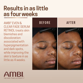 Ambi bottle held to show 1 fl oz size and travel-friendly scale