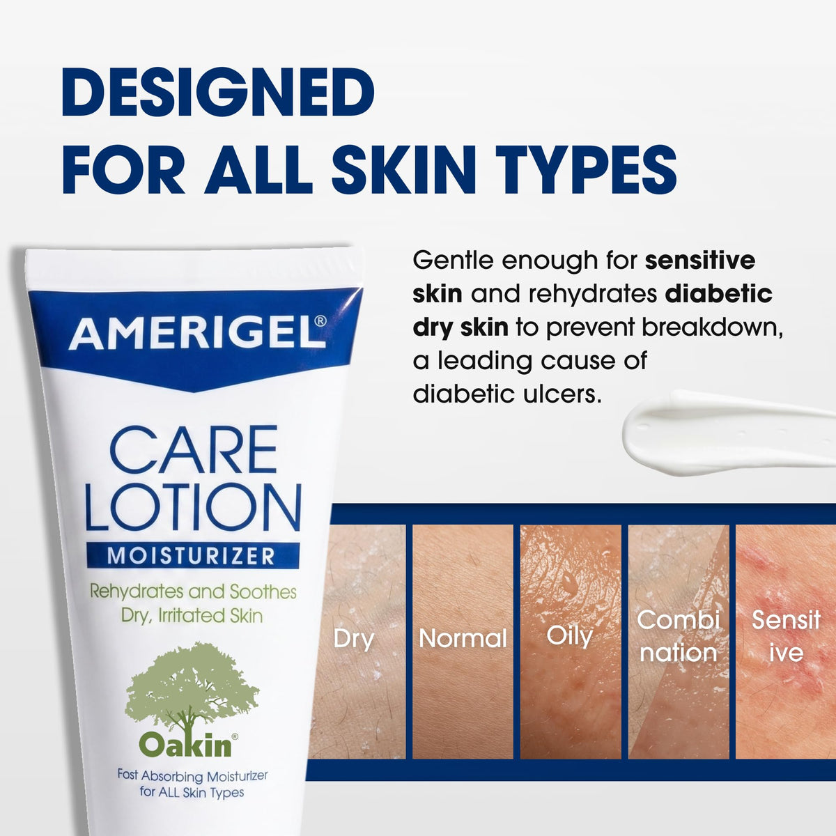 AMERIGEL Care Lotion cap and nozzle detail illustrating precise, mess-free dispensing