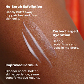 AmLactin applied to elbow showing smoother skin benefit