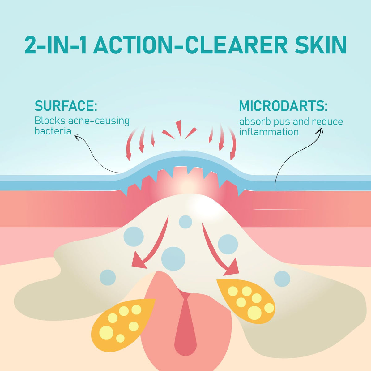 ANGTICS patch applied on cheek demonstrating discrete overnight wear