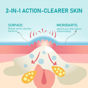 ANGTICS patch applied on cheek demonstrating discrete overnight wear