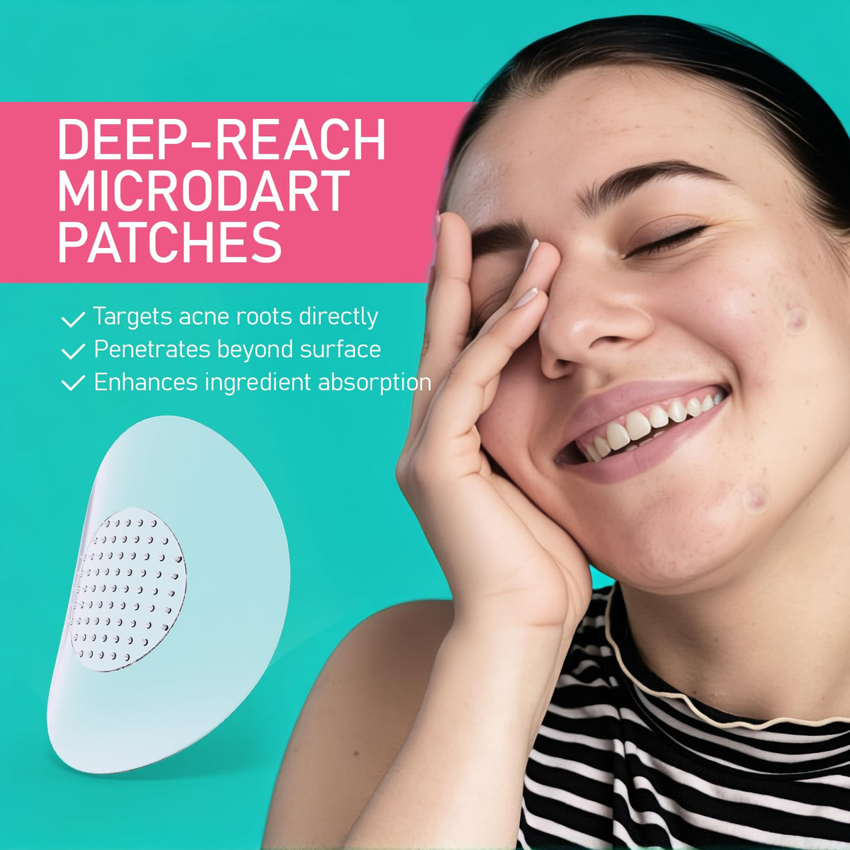 ANGTICS close-up of dissolvable microdart tips delivering actives