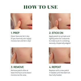 AOA STUDIO lifestyle on bathroom counter, easy-to-use spot treatment kit