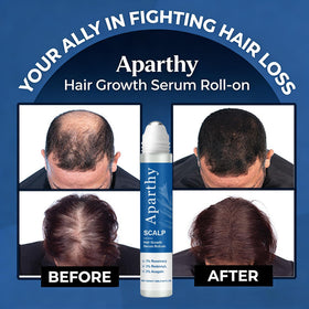 Aparthy rollerball applicator close-up for precise, no-mess scalp targeting