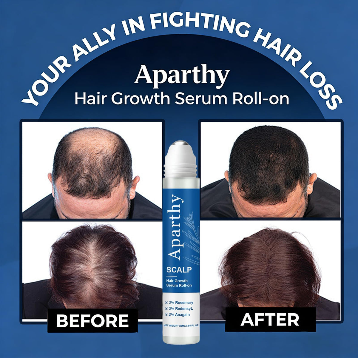 Aparthy rollerball close-up demonstrating precise, mess-free application benefit