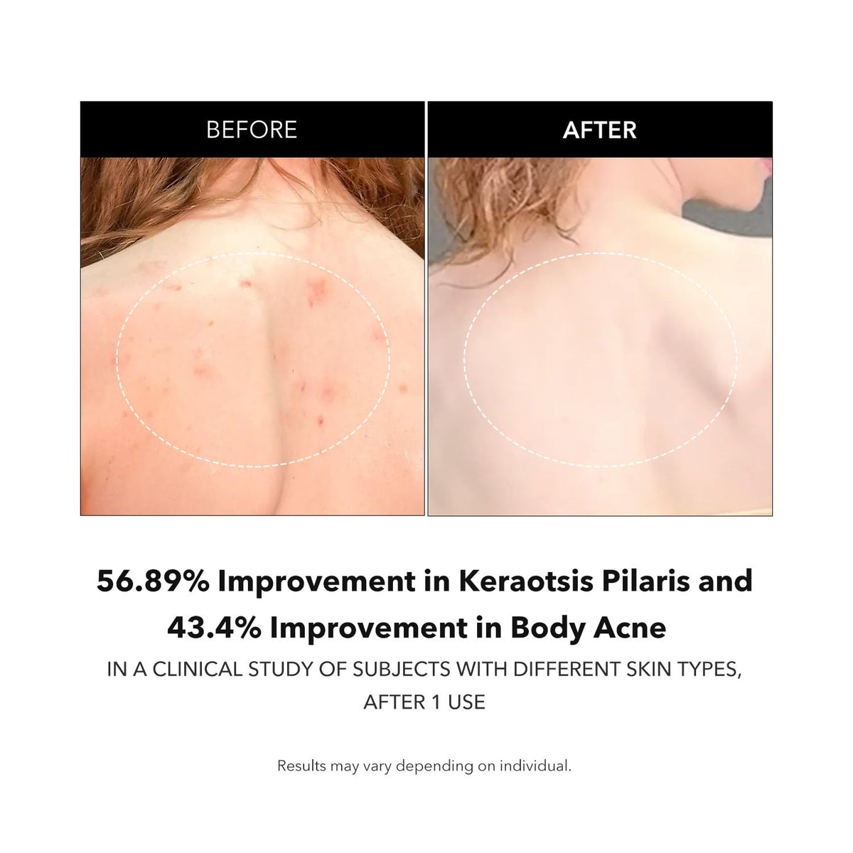 APRILSKIN visual of ceramide and panthenol icons emphasizing hydration and barrier support