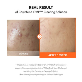 APRILSKIN label highlighting niacinamide and zinc oxide for even-tone benefit