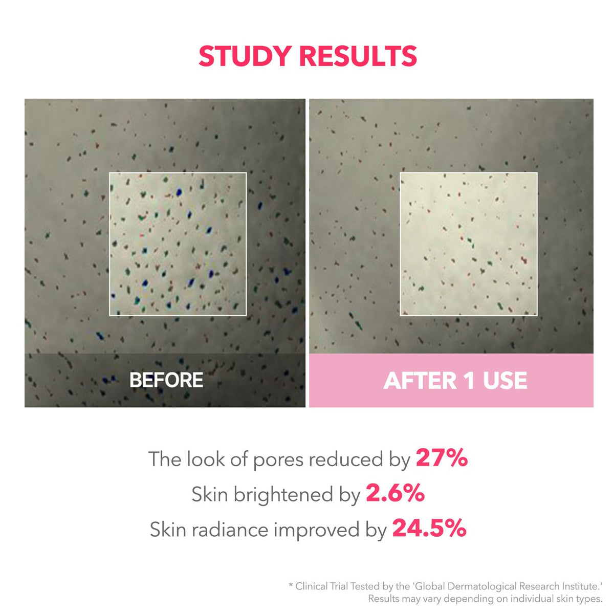 APRILSKIN visual of TXA and niacinamide highlighting toning benefit