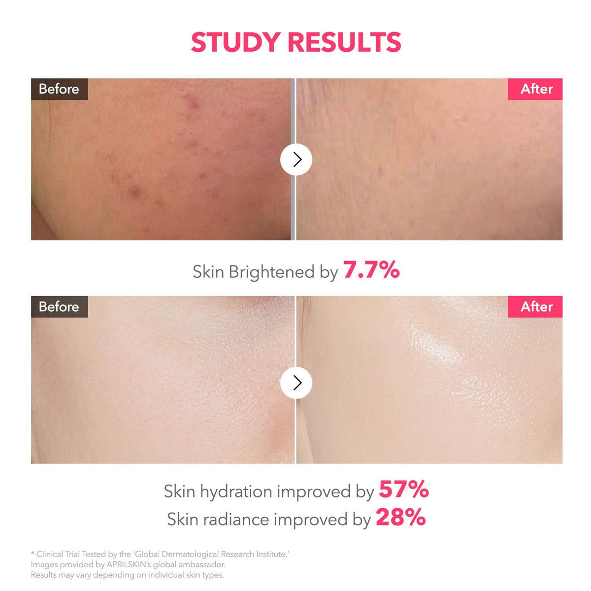 APRILSKIN lifestyle shot of mask worn overnight for glow