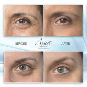 Applying Aqua Mineral gel under eye demonstrating quick de-puffing and smoothing effect