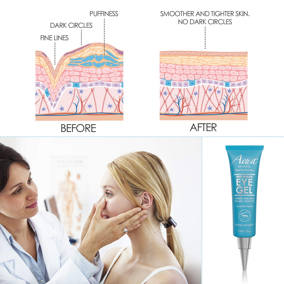 Side-by-side Aqua Mineral before and after under-eye comparison showing visible tightening