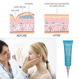 Side-by-side Aqua Mineral before and after under-eye comparison showing visible tightening