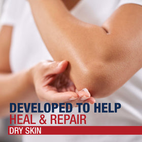 Aquaphor on chapped lips and cuticles to moisturize and help healing