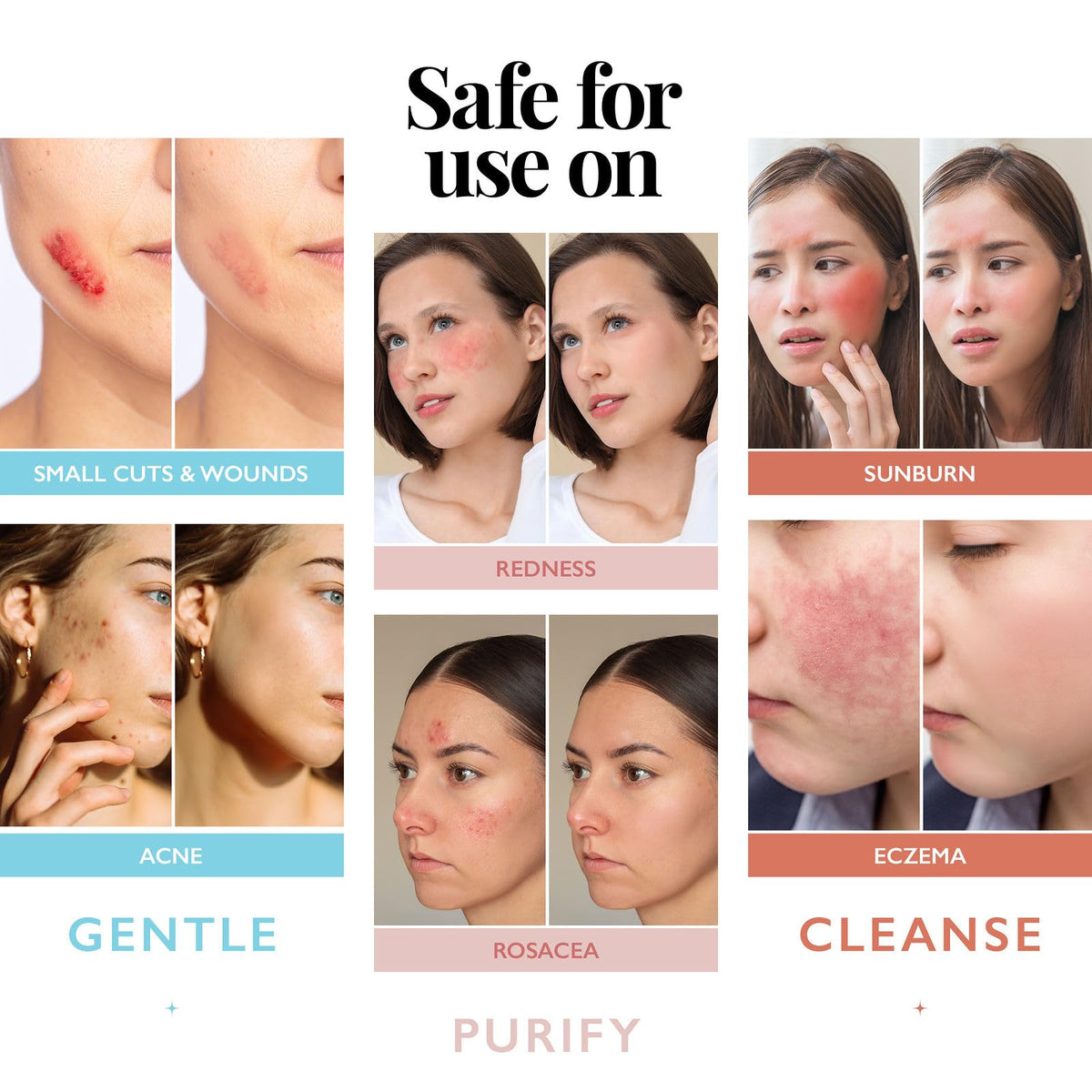 Aquia before and after mild redness showing calming skin benefits