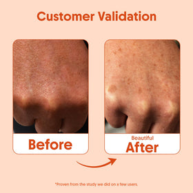 Aravi Organic being applied to forearm for even, non-greasy coverage