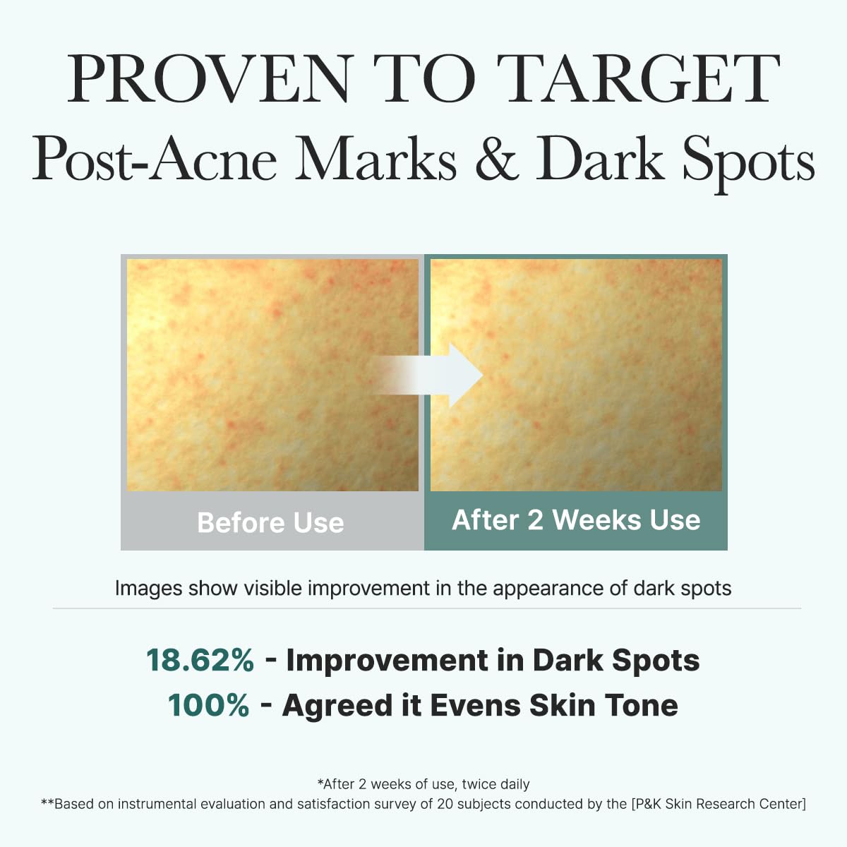 ARENCIA before and after scale showing refined skin texture