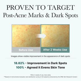 ARENCIA before and after scale showing refined skin texture