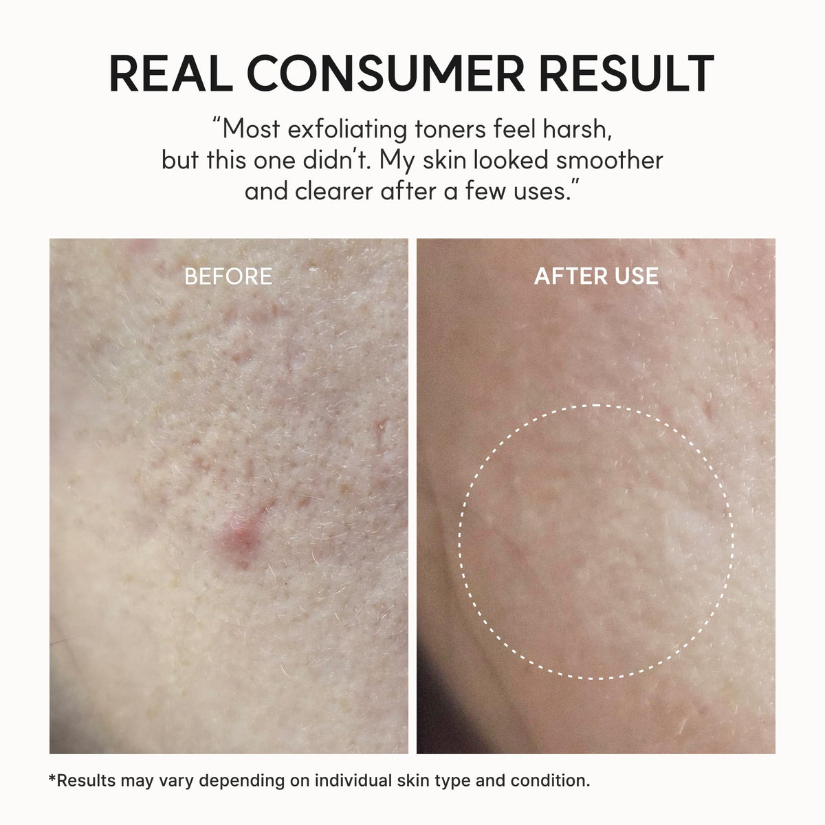 ARENCIA Erasor Shot in a bathroom routine setting showing layering benefit