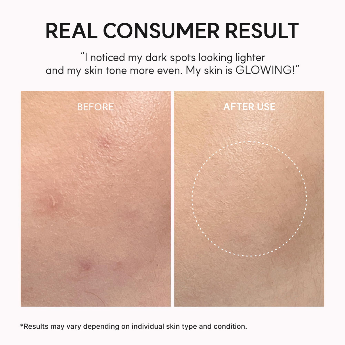ARENCIA eye area application demo showing gentle use and targeted support