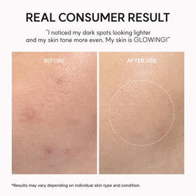 ARENCIA eye area application demo showing gentle use and targeted support