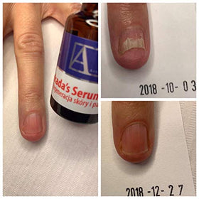 ARKADA serum texture on skin demonstrating lightweight absorption and smooth finish