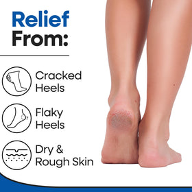 ARMSTRONG AMERICA open-toe sock design displaying breathable comfort