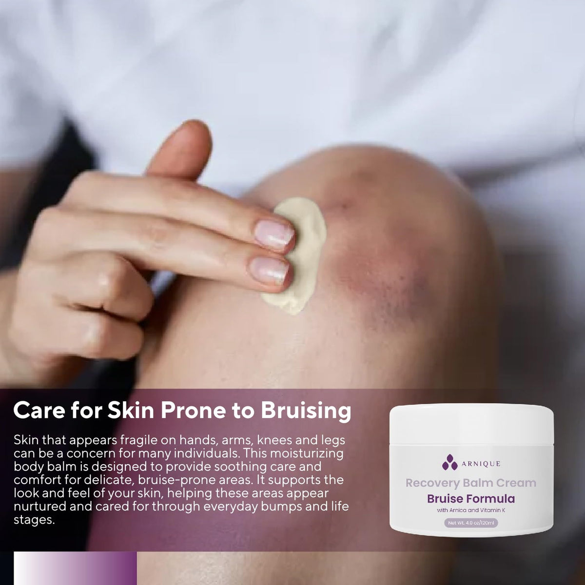 Arnique used on legs and arms in lifestyle scene showing improved appearance