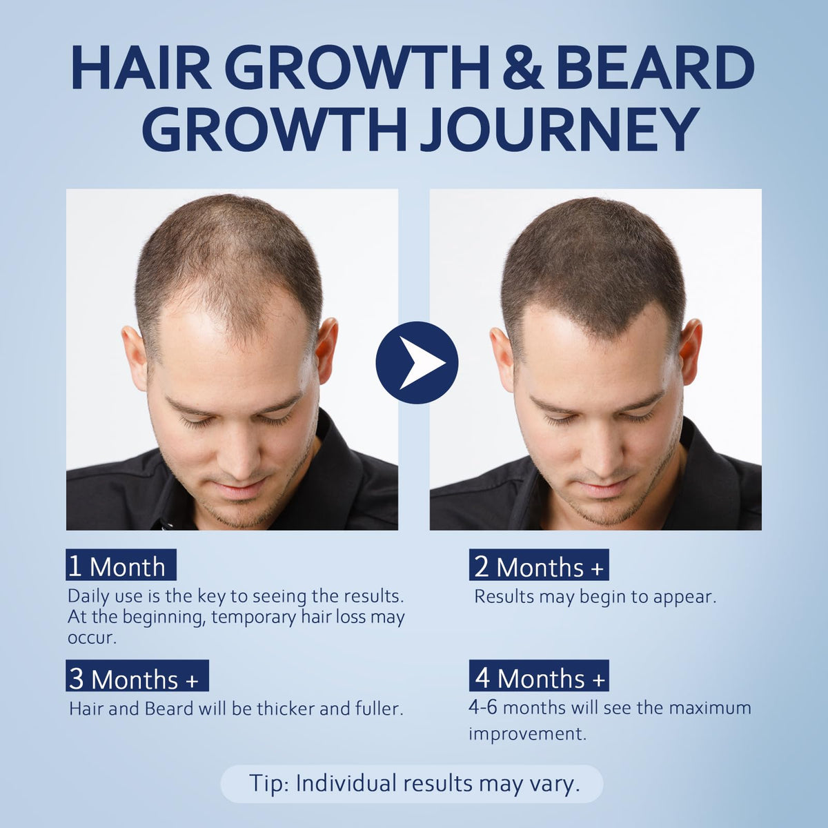 Artimore applied to scalp demonstration for targeted thinning benefit