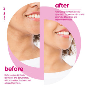Artnaturals hand applying serum to face illustrating easy daily use benefit
