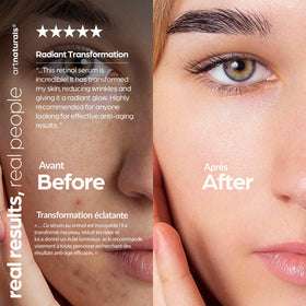 ArtNaturals applying a small amount to under-eye area to diminish fine lines