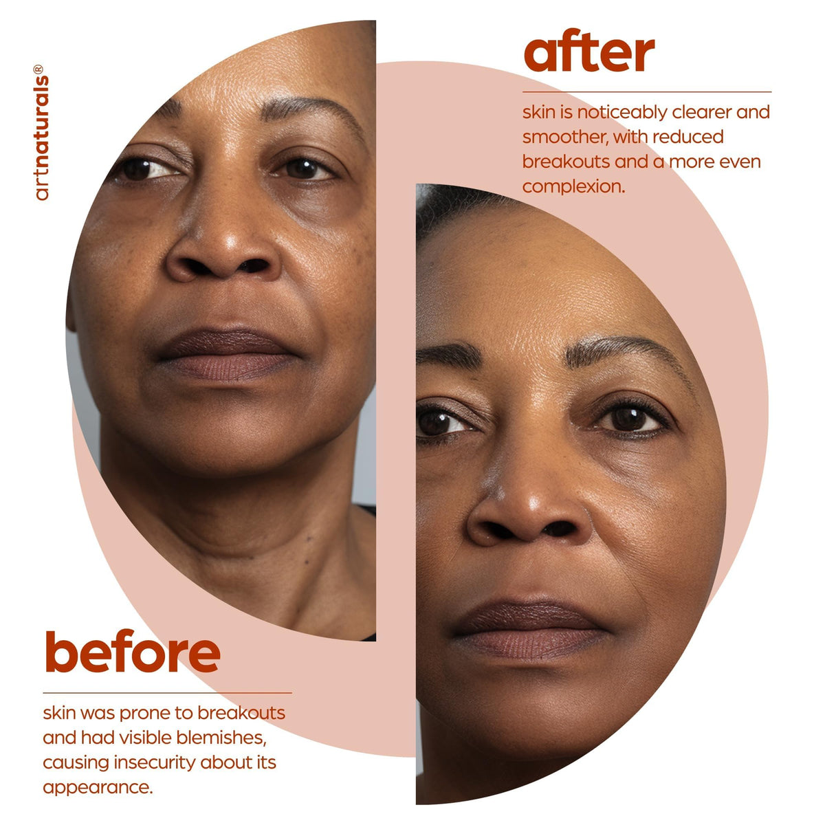 Artnaturals serum staged on bathroom counter showing easy integration in routine