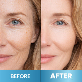 Arvesa ingredients collage featuring collagen and hyaluronic acid benefits