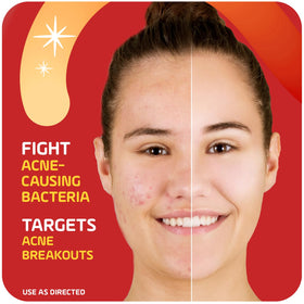 Asepxia fingertip application demonstrating targeted spot treatment