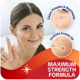 Asepxia salicylic acid ingredient callout highlighting pore penetration