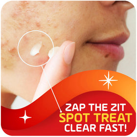 Asepxia open tube texture showing cream consistency for fast absorption