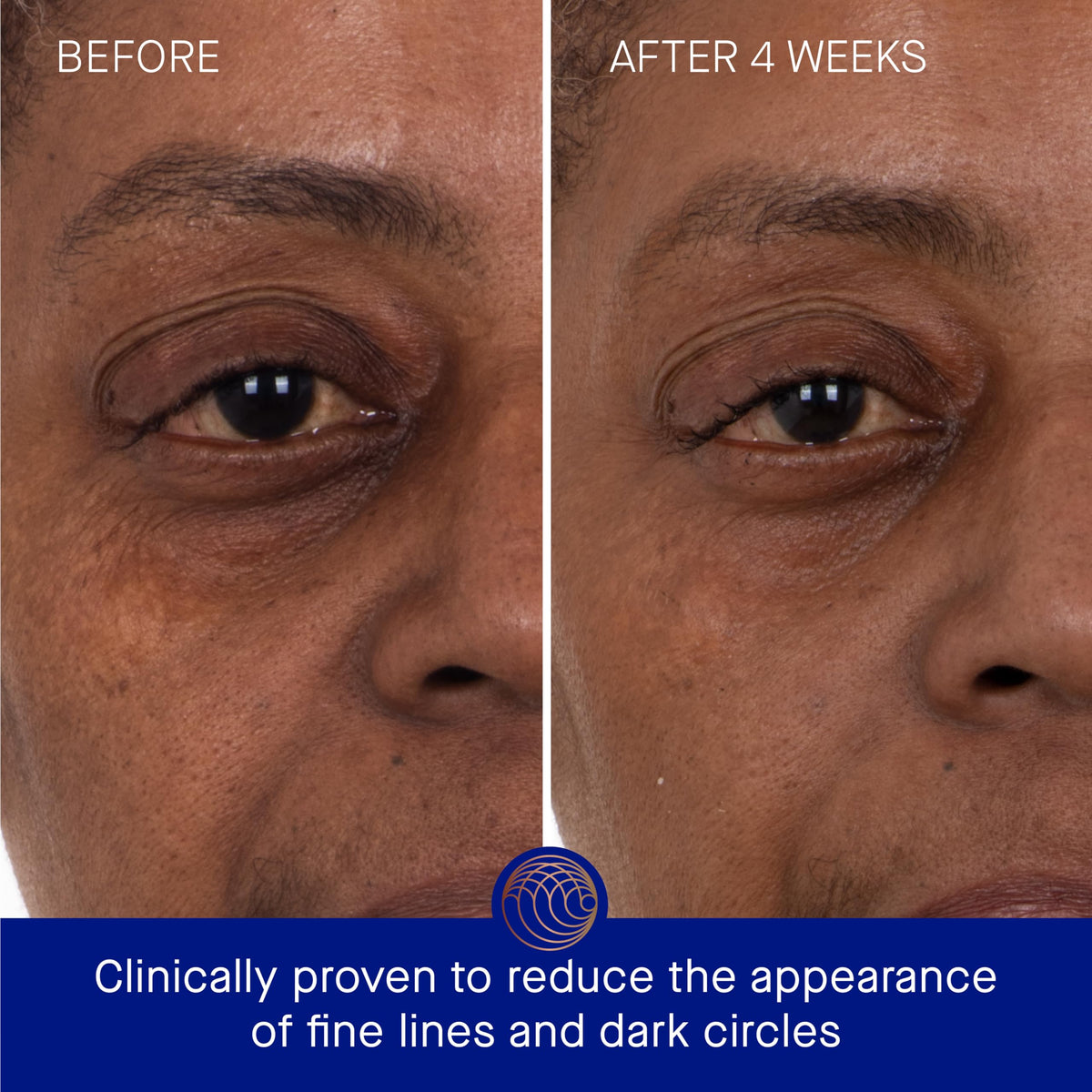 Augustinus Bader close-up hydrogel patch texture showing cooling hydration benefit