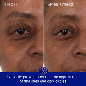Augustinus Bader close-up hydrogel patch texture showing cooling hydration benefit