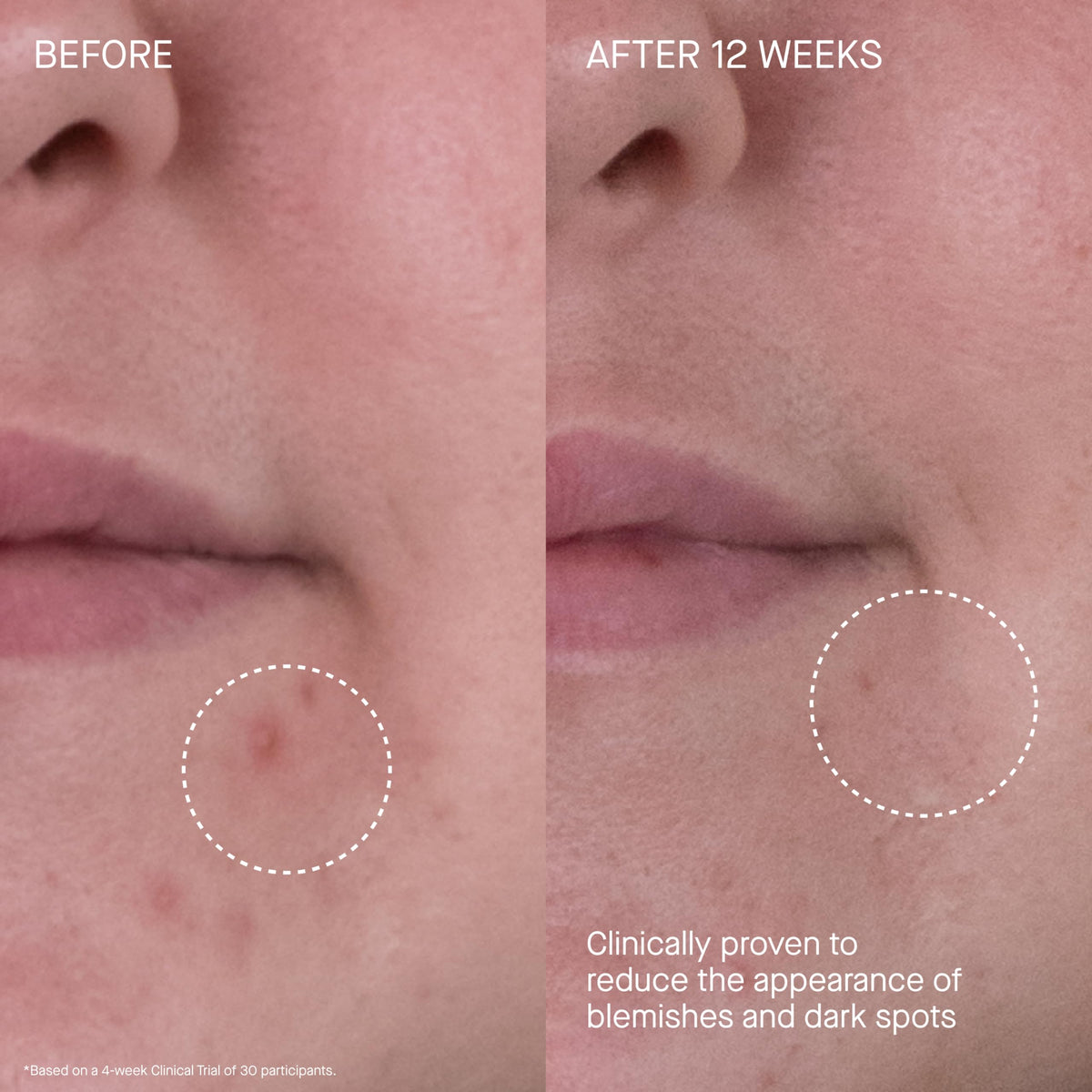 Augustinus Bader application on neck illustrating coverage and skin-smoothing benefit