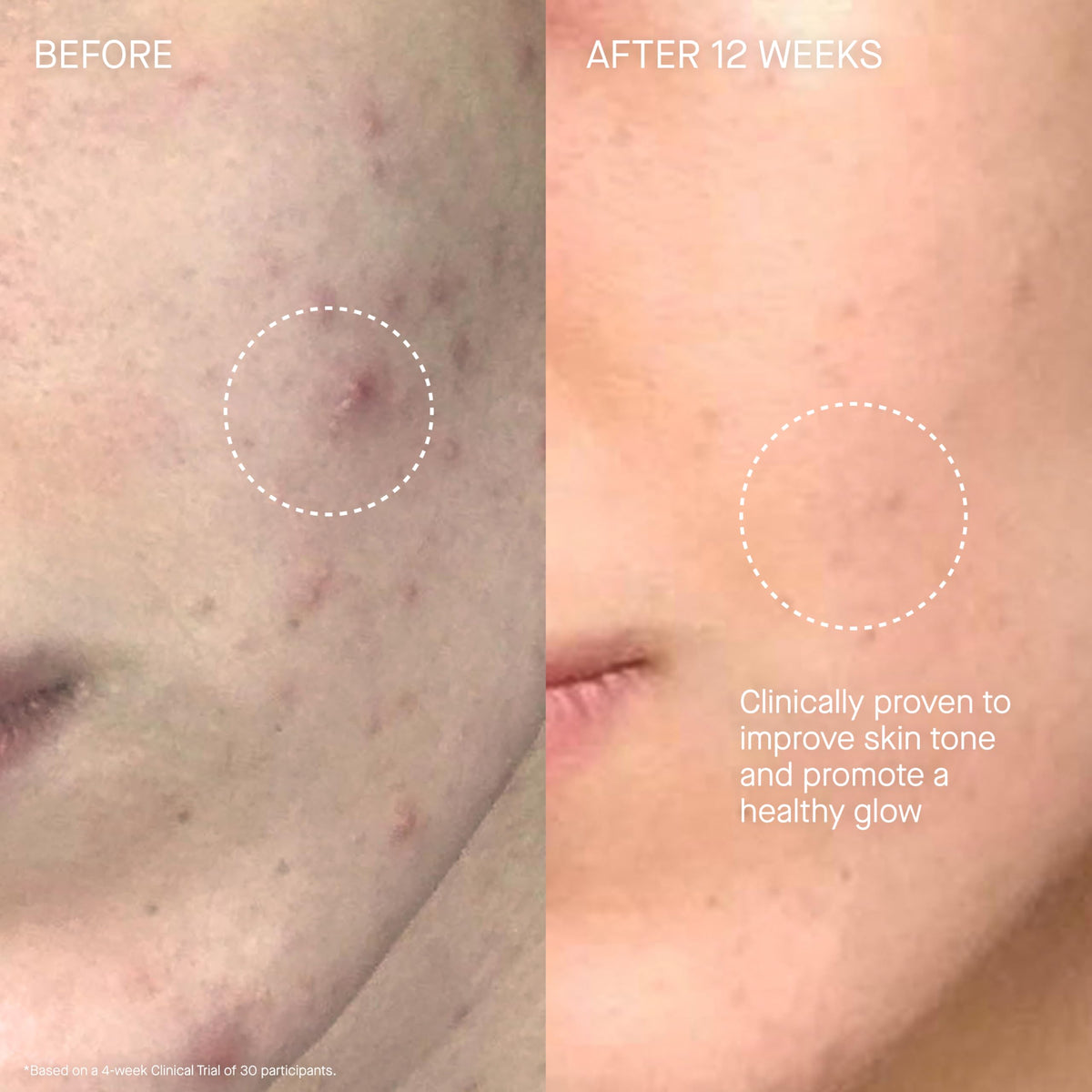 Augustinus Bader applied to neck and décolleté illustrating hydrating coverage benefit