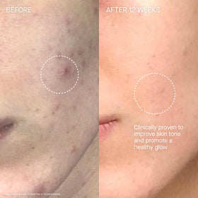 Augustinus Bader applied to neck and décolleté illustrating hydrating coverage benefit