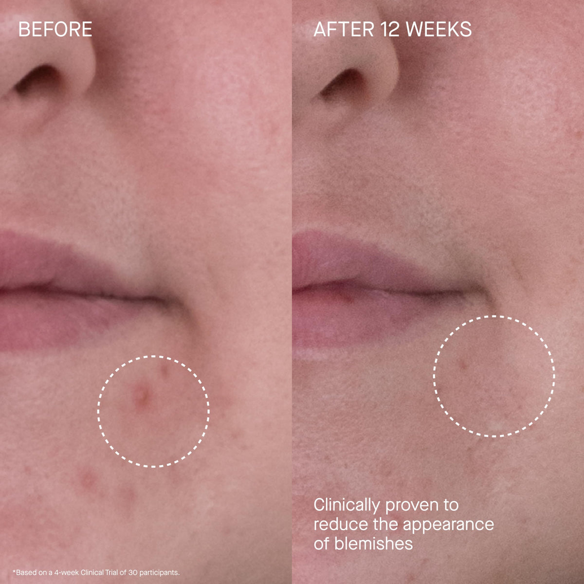 Augustinus Bader moisturizer used on neck and décolleté to boost hydration and resilience