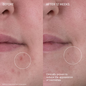 Augustinus Bader moisturizer used on neck and décolleté to boost hydration and resilience