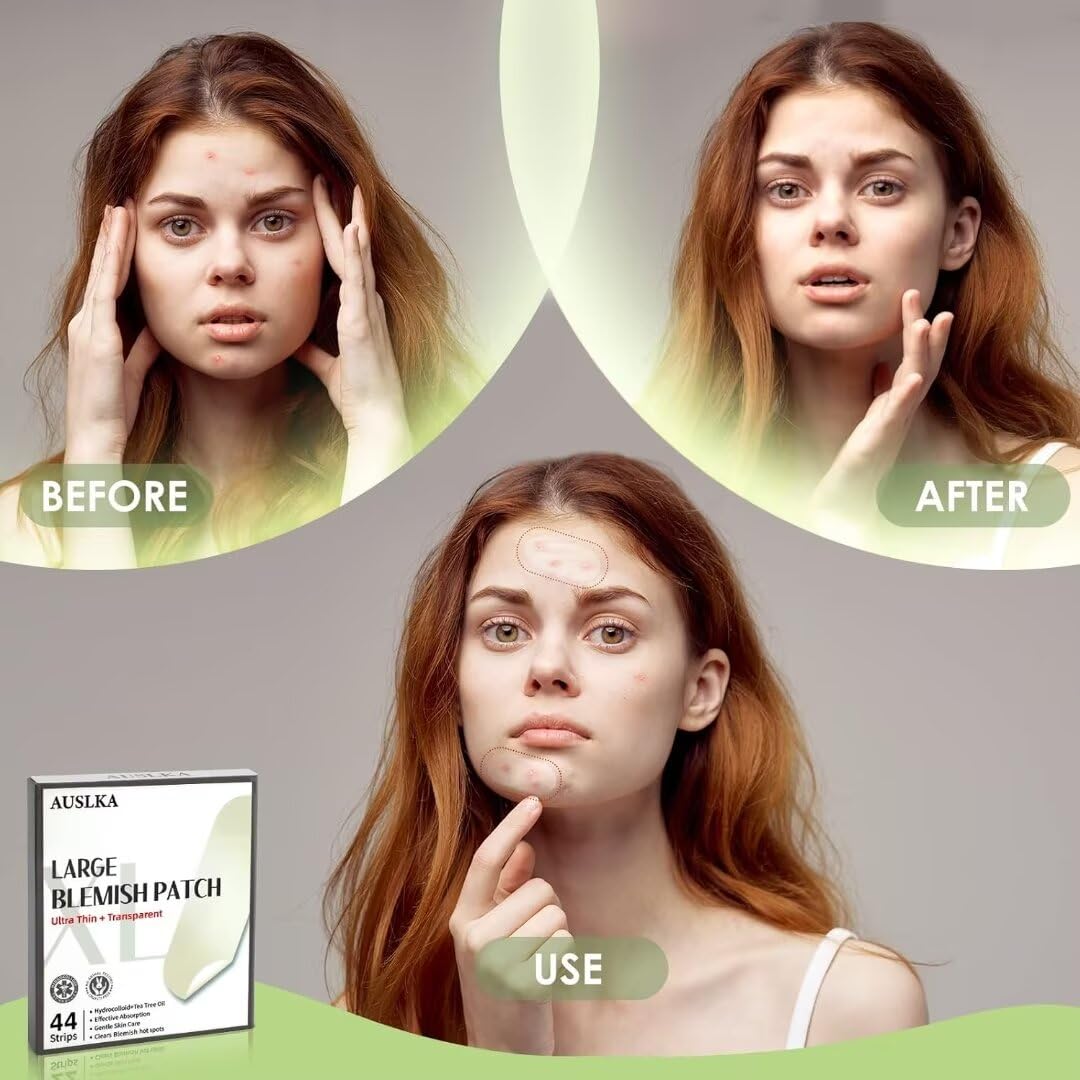 AUSLKA patch on chest covering large blemish and protecting skin