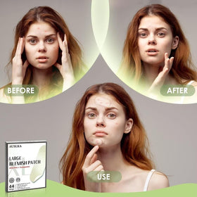 AUSLKA patch on chest covering large blemish and protecting skin